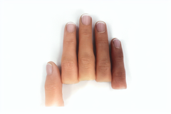 Fingervo Custom Realistic Finger Prosthetics